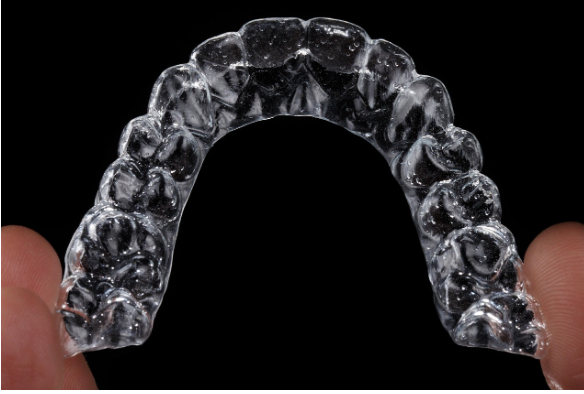 Invisalign Adelaide’ Active Coastal Lifestyles in Glenelg